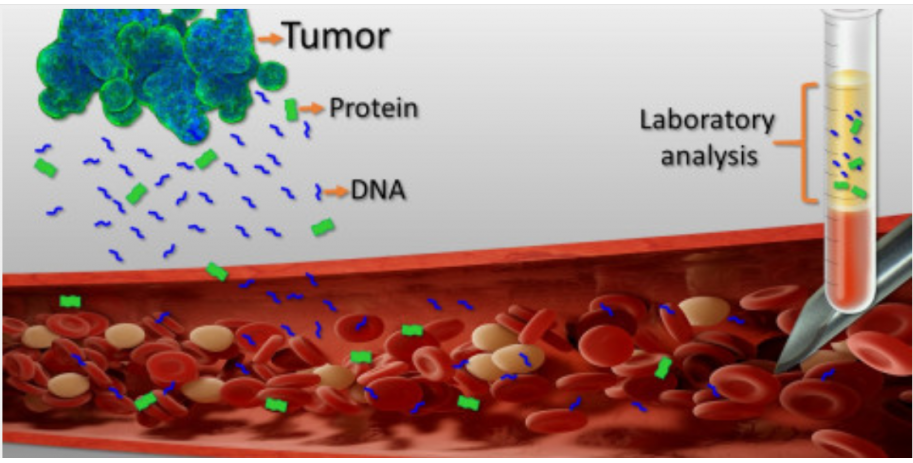 Liquid biopsy.Circulating tumour cells, a non invasive cancer detection test